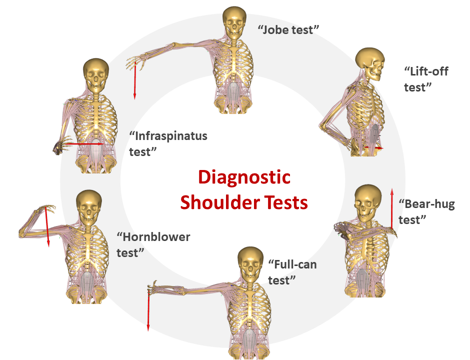 Biomechanical Evaluation Of Diagnostic Tests For Rotator Cuff Lesions 